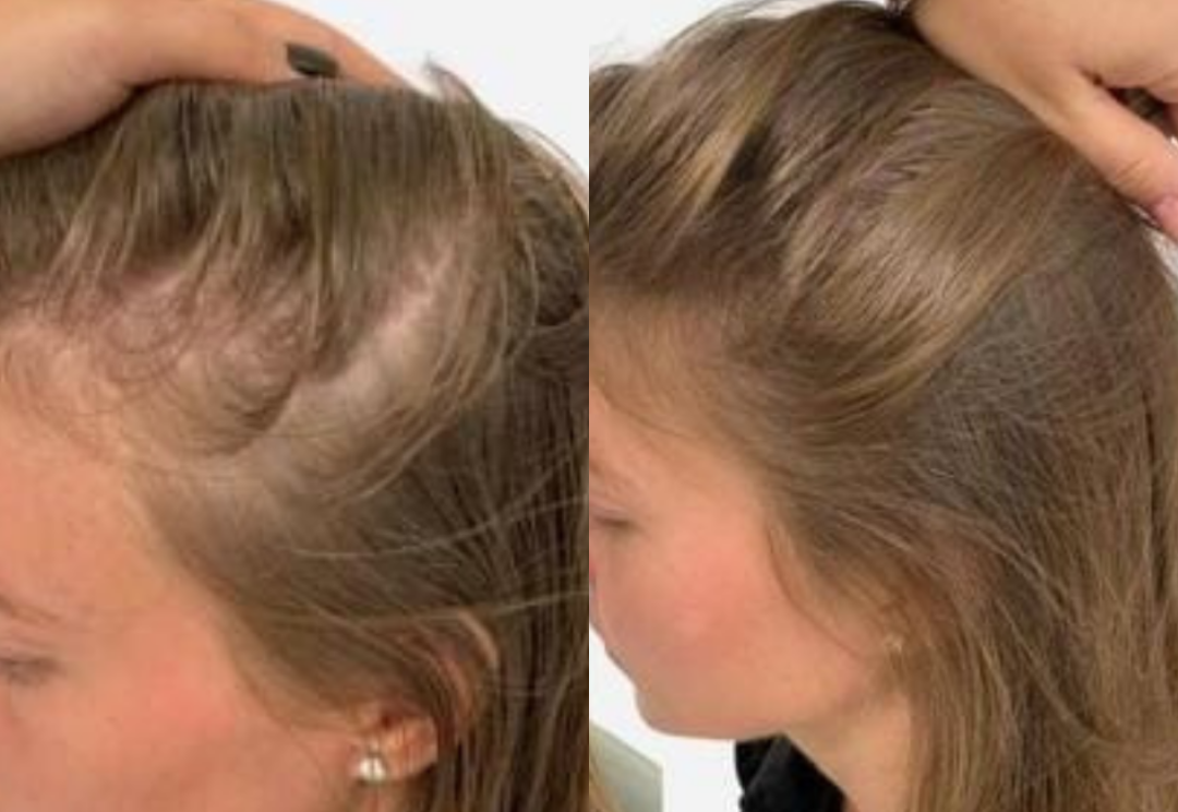 Best Hair Growth Spray Products EZZ OFFICIAL