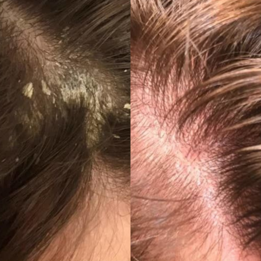 Best Hair Growth Spray Products EZZ OFFICIAL