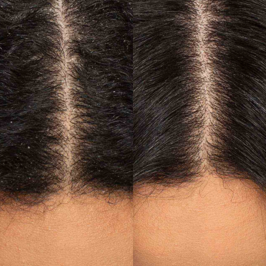 Best Hair Growth Spray Products EZZ OFFICIAL